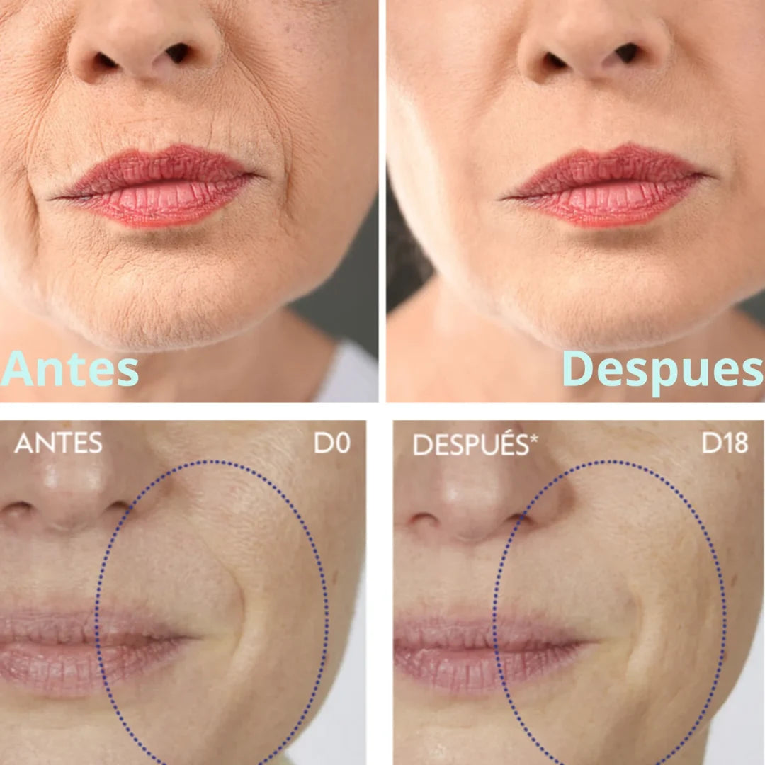 RESVERATROL Logra una piel más firme con menos arrugas | Un cabello y uñas más fuerte y resistentes